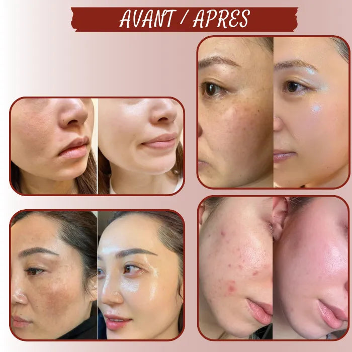 Soin anti-âge visage - Acide hyaluronique et probiotiques galactomyces