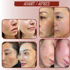 Soin anti-âge visage - Acide hyaluronique et probiotiques galactomyces